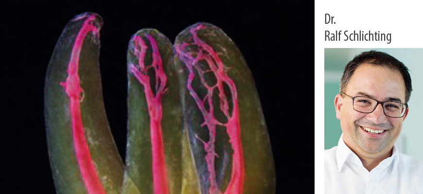 Dr. Ralf Schlichting: Moderne endodontische Behandlungskonzepte – ein Update – Kurs: 9812