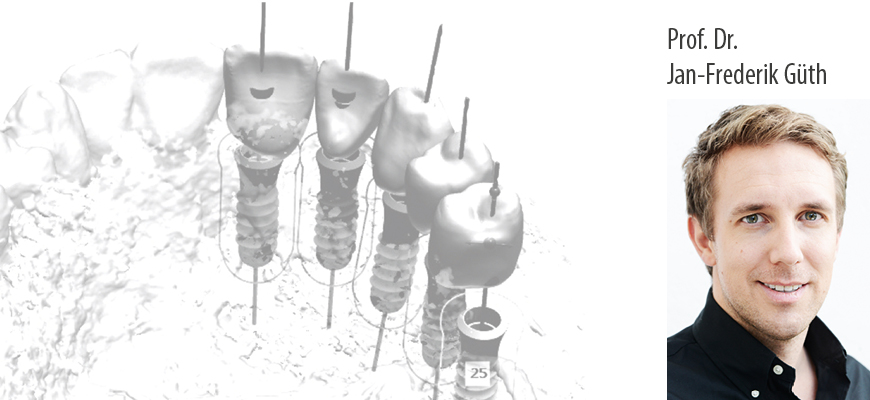 Prof. Dr. Jan-Frederik Güth: Komplexe prothetische Fälle erfolgreich lösen - Kurs: 9815