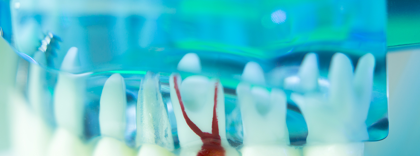 Prof. Dr. Michael Hülsmann: Erfolgreiche Endodontie: Ein Konzept für die Praxis! - Kurs: 9802