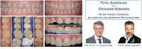 Prof. Dr. Dr. h.c. Thomas Attin & PD Dr. Alexis Ioannidis: Total-Sanierung von Erosions-Gebissen – Schrittweises Vorgehen mit direkten und indirekten Restaurationen - Kurs: 9826